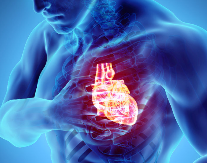 Нарушение коронарной микроциркуляции и риск развития сердечной недостаточности с сохранной фракцией выброса (СН-сФВ)